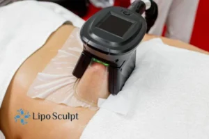 Are The Results From Aqualyx Permanent? 4 Compare Aqualyx Hickstead to other fat reduction treatments.