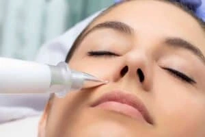 Best Actinic Keratoses Removal 3 Actinic keratoses Hickstead solutions - book in today!