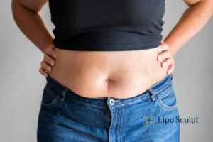 Bidding Farewell to Muffin Tops with Aqualyx Fat Injections 2 Do you wish you could reduce your muffin top Hickstead With Aqualy fat dissolving injections you can!